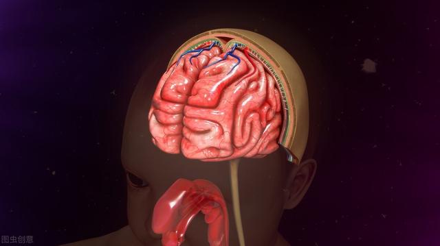 完美预防，避免蛛网膜下腔出血后的低级并发症错误-图1